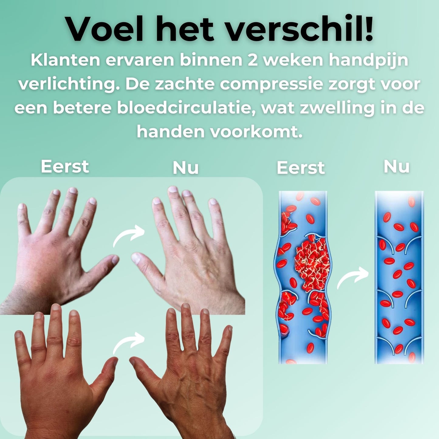 Pijnverlichtende Compressie Handschoenen