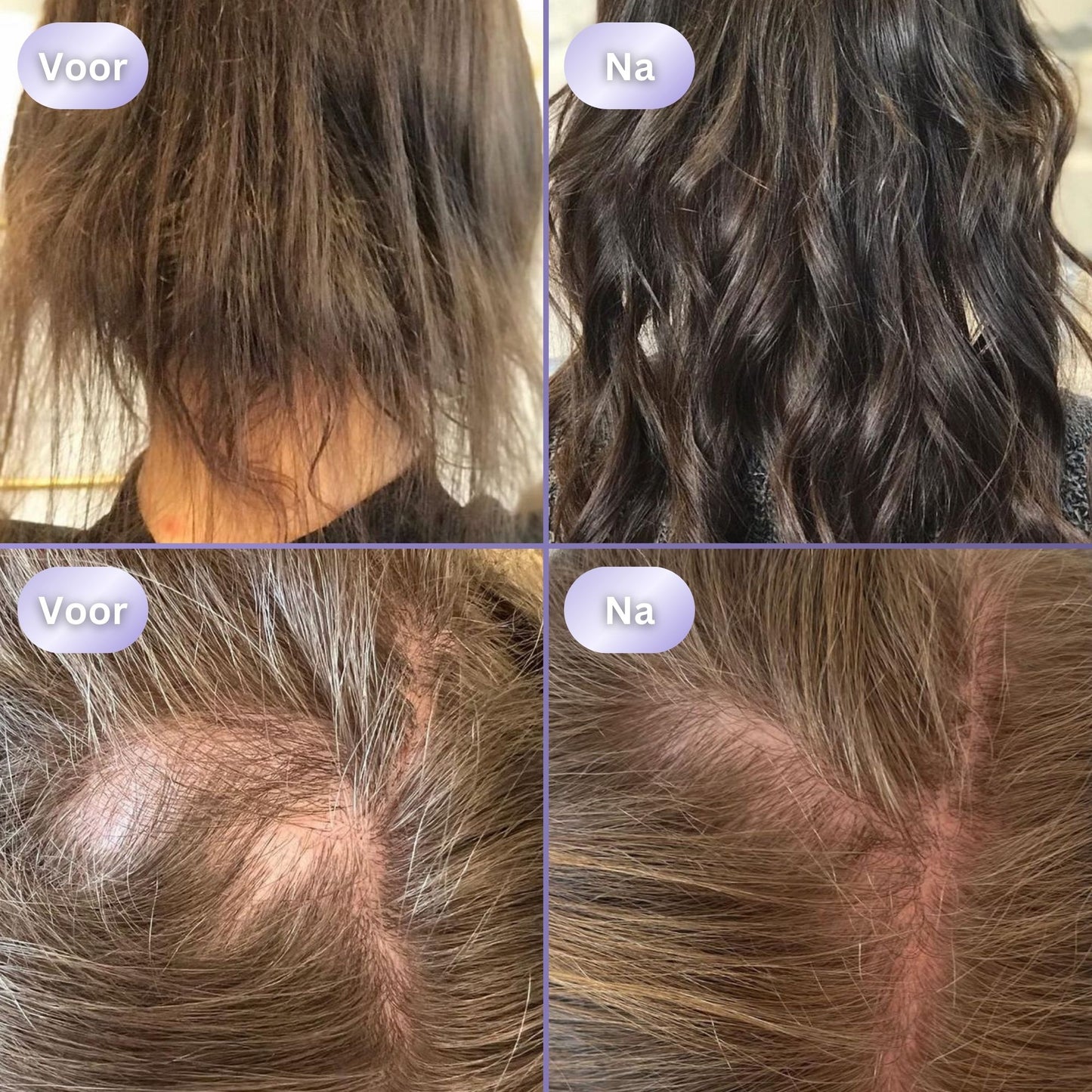 HairGlow 3in1 Haargroei Borstel