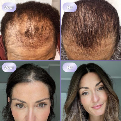 HairGlow 3in1 Haargroei Borstel